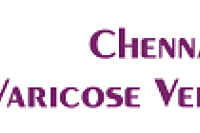 Expert Care for Varicose Veins