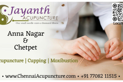 Experience Holistic Healing at Jayanth Acure Health Care in Chennai | Acupuncture Treatment